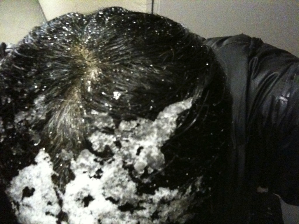 前頭部には雪が積もって髪の毛がべちゃっとなっています。